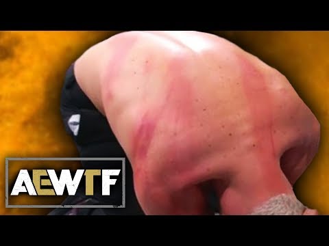 AEW: Dynamite WTF Moments (5 Feb) | Cody Takes 10 Lashes From MJF