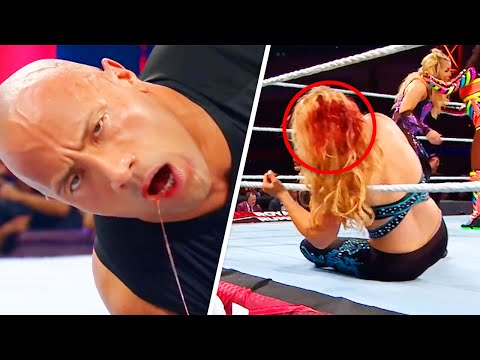 10 Worst WWE Injuries